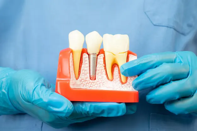 Are Implants Suitable For Everyone?