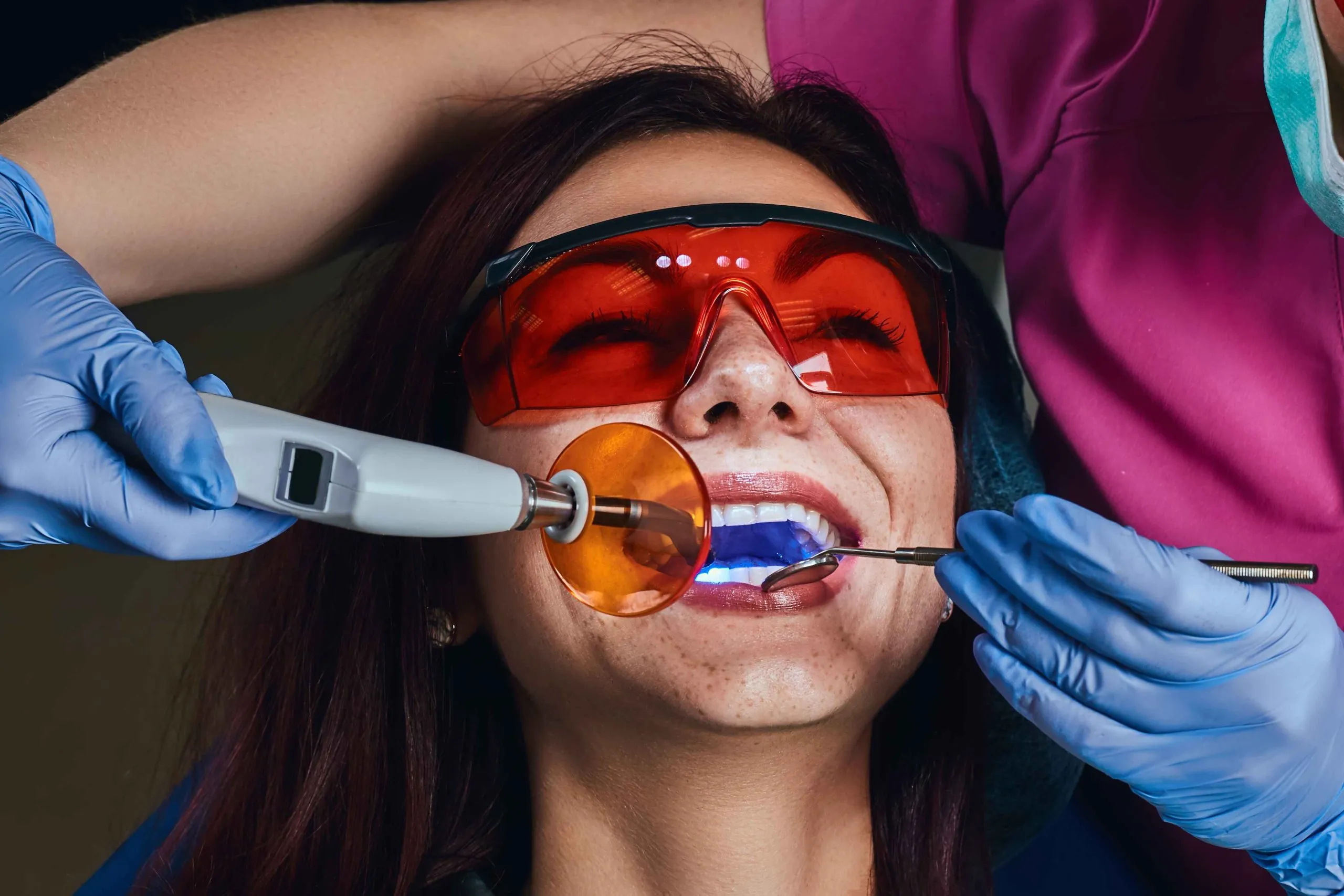 Laser Teeth Whitening