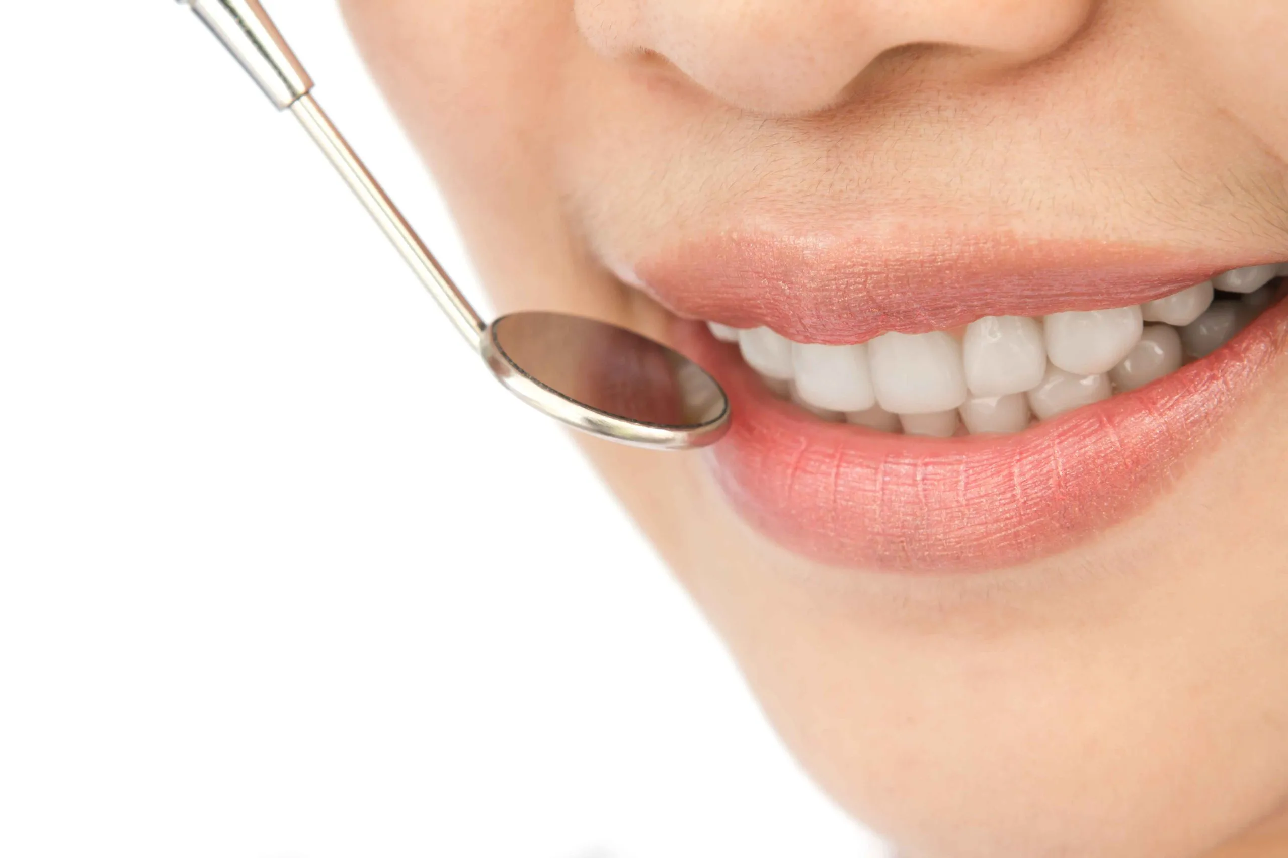 Durathin Veneers